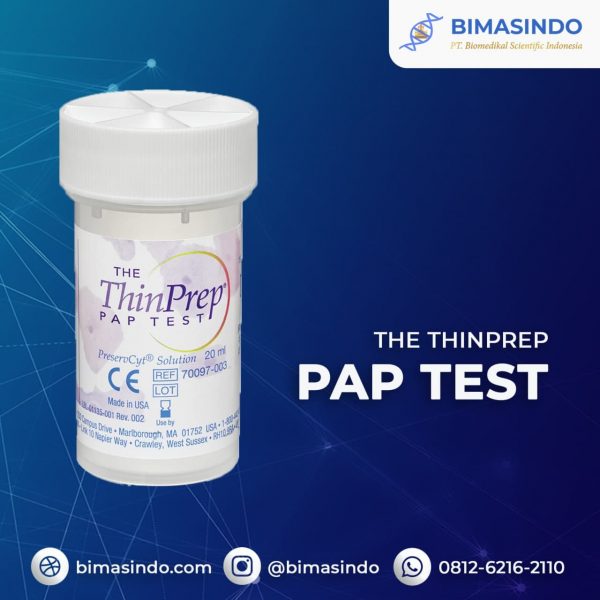 ThinPrep Pap test